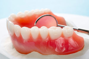 dentiera impianto dentale