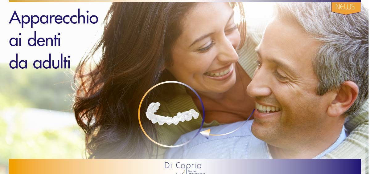 apparecchio ai denti da adulti | Studio Dentistico Di Caprio | Dentista a Vairano Scalo